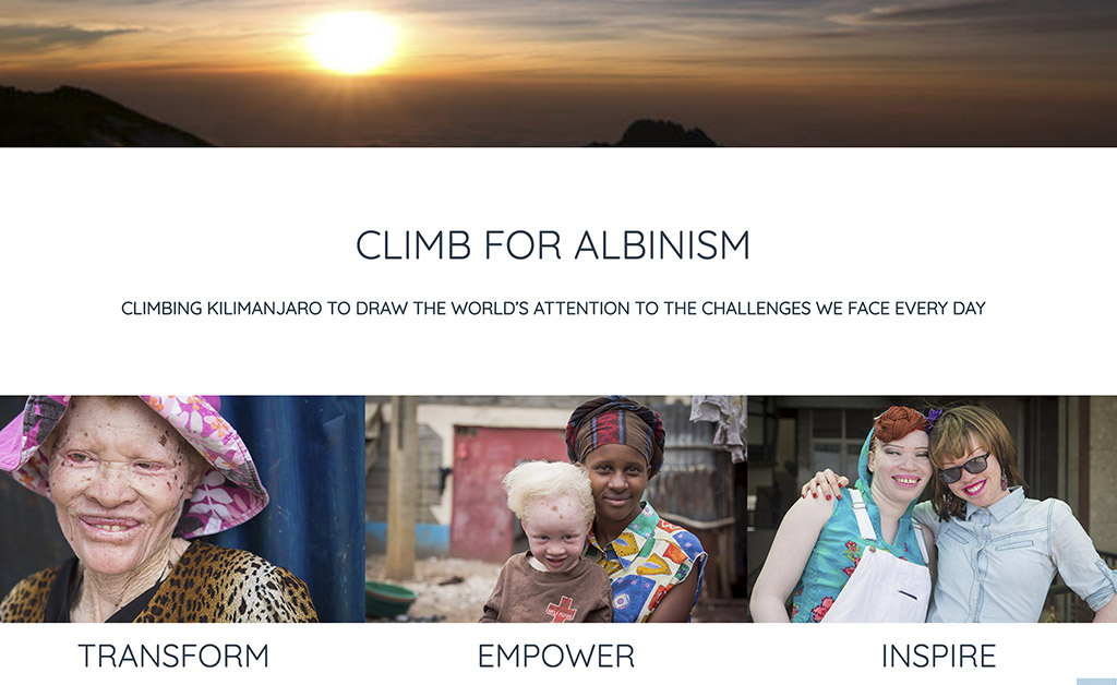 Climb for Albinism website is live