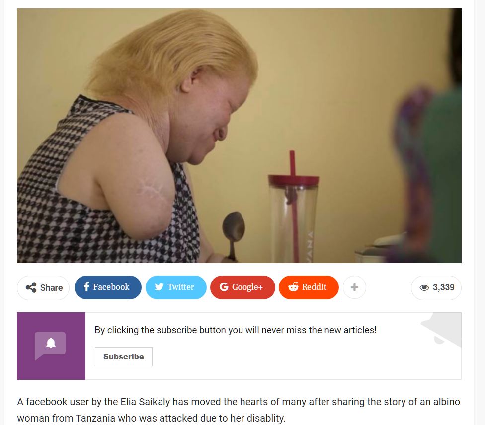 Story of an albino woman who survived an attack in Tanzania